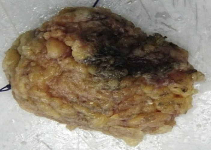Description of the image